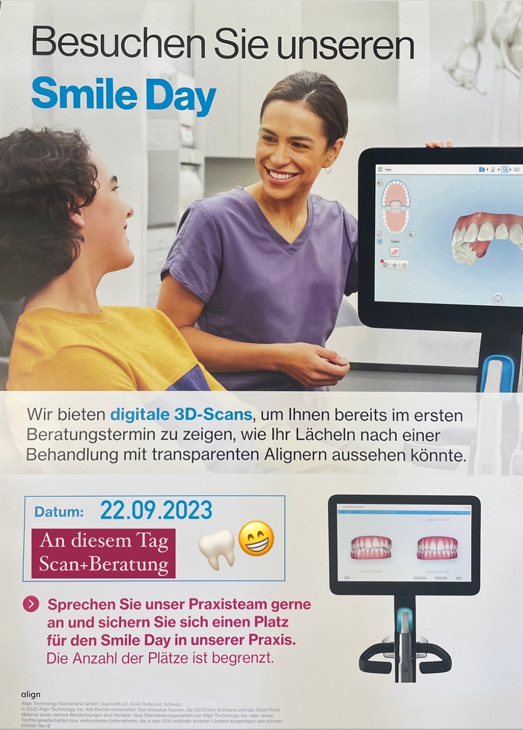 Wie Aligner Ihr Lächeln verschönern können?